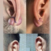 A2FE7A02-1CEF-4728-83D3-359603F6A7FC